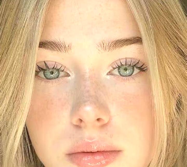 escort Glenunga