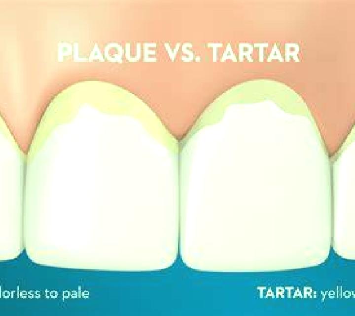 escort Tartar
